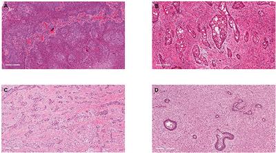 Malignant Odontogenic Tumours: A Systematic Review of Cases Reported in Literature